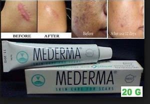 1 Tube X 20g Mederma GEL Acne Scar Removal Keloid Skin Care Treatment ...