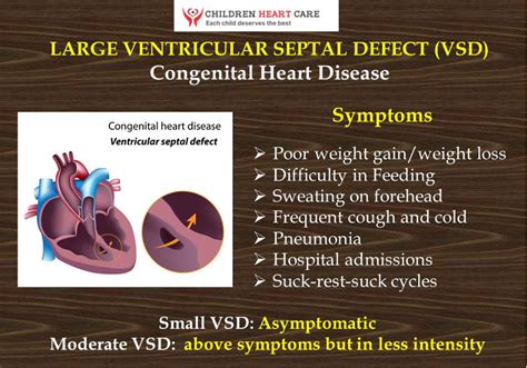 Symptoms Due to Ventricular Septal Defect (VSD) - Dr. Gaurav Agrawal