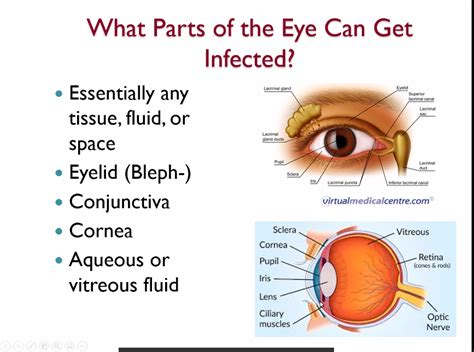 Eye Infection From Contacts