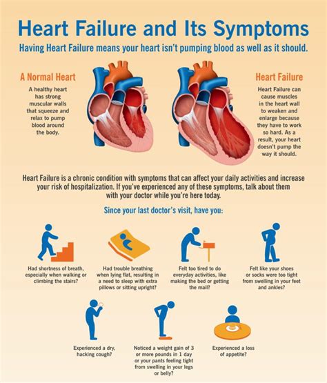 Congestive Heart failure: Causes and Types | Jugaadin News