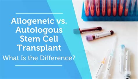 Allogeneic vs. Autologous Stem Cell Transplant: What Is the Difference ...