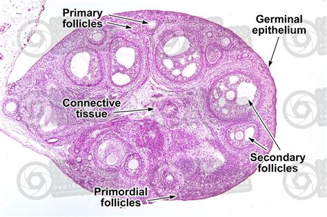 Rabbit. Ovary. Transverse section. 32X - Rabbit - Mammals ...