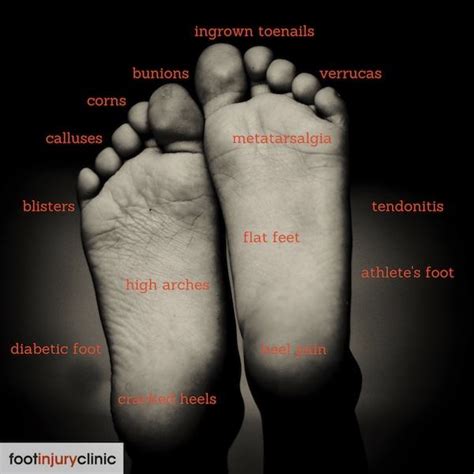 9 Reasons To Visit A Podiatrist | Foot Injury Clinic