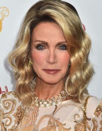 Donna Mills Plastic Surgery Update – Surgery Lists