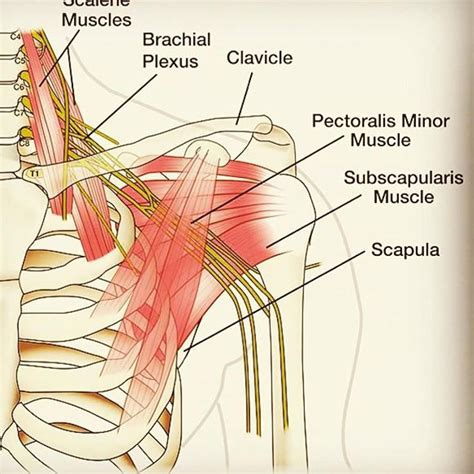 Brachial plexus anatomy from our partnership ... | Brachial, Plexus ...