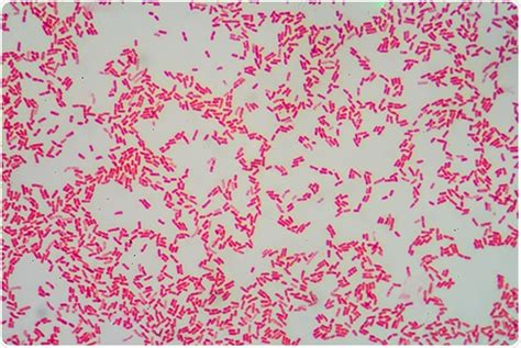 Pseudomonas Aeruginosa Gram Stain / Untitled Normal Page : Pseudomonas ...