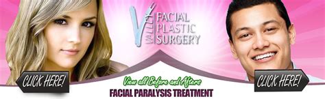 Facial Paralysis Treatment | Facial Plastic Surgery