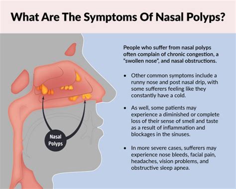 Nasal Polyps: Causes, Symptoms, Treatments, and Prevention