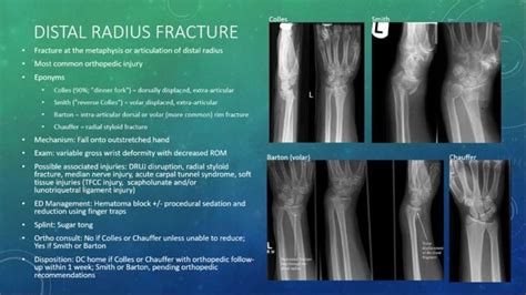 Distal Radius Fracture Distal radius fracture is ... | Radii, Fracture ...