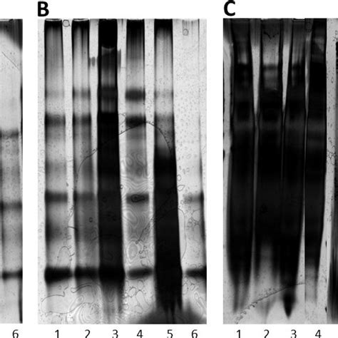 The comparison of urinary protein precipitation methods on SDS-PAGE ...