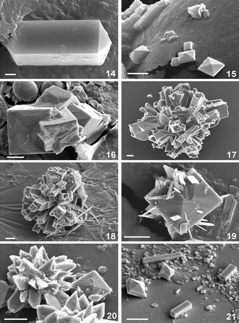 Calcium Oxalate Crystals In Plants