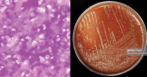 Biochemical Test of Bacteria Notes - Microbe Notes