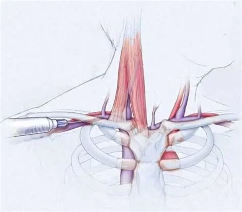 Anatomy: subclavian vein | Medicine 2024