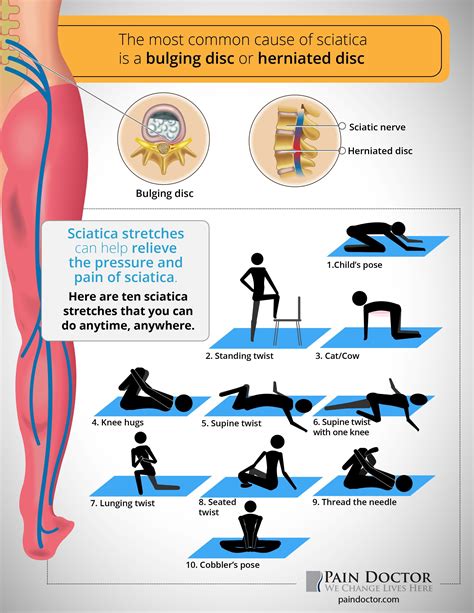 what is the most effective pain relief for sciatica - Tawnya Stroud