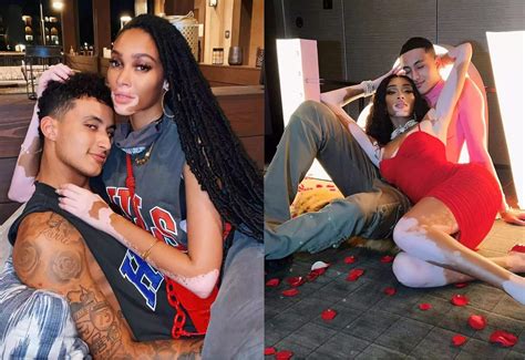 Who is Kyle Kuzma’s Girlfriend, Winnie Harlow?