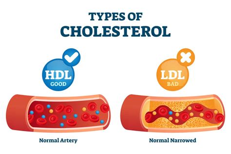 HDL vs. LDL Cholesterol: What's the Difference?