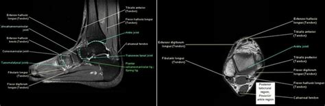 The MRI Technologist Role in Foot/Ankle Positioning | All-American ...