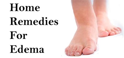 Home Remedies for Edema Treatment