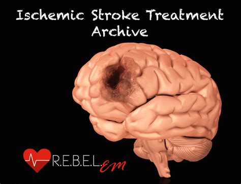 Ischemic Stroke Treatment Archive - R.E.B.E.L. EM - Emergency Medicine Blog