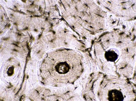 'Compact Bone Skeletal Sys. Photomicrograph X100' Photographic Print ...