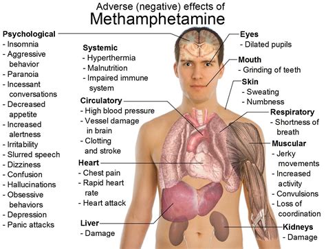 What is Amphetamine? - Rehab Guide