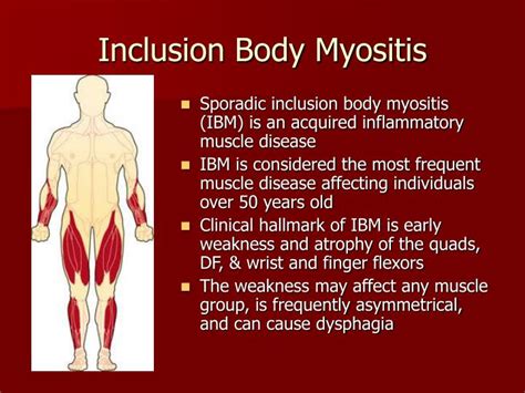 PPT - Inclusion Body Myositis PowerPoint Presentation - ID:4073591