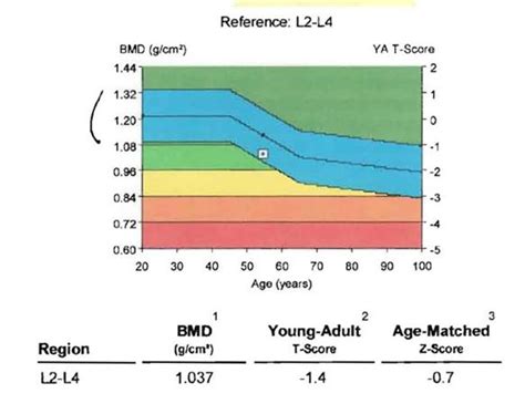 Bone density test results - moonmyte