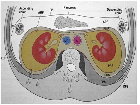 [Figure, Retroperitoneum] - StatPearls - NCBI Bookshelf