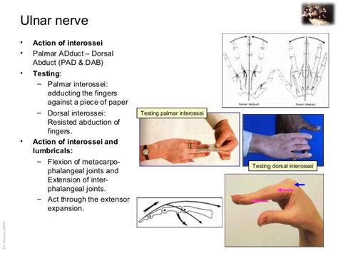 Ulnar nerve - Course and Innervation | Epomedicine