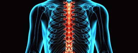 Thoracic spine x-ray