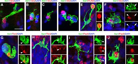 Iba1 microglia phagocytose neural precursor cells in the developing ...