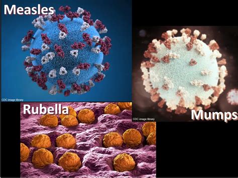 Measles, Mumps, and Rubella Diagram | Quizlet