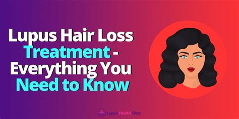 Lupus Hair Loss Treatment — Everything You Need to Know | by Janeen ...