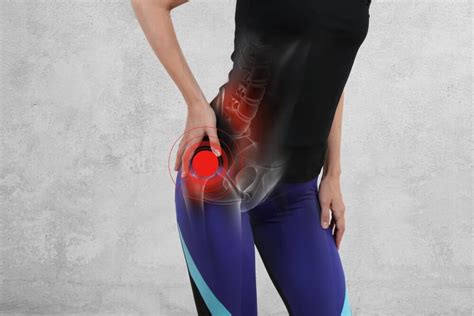 Hip Flexor Strain Treatment in Dallas, TX | SPORT Orthopedics