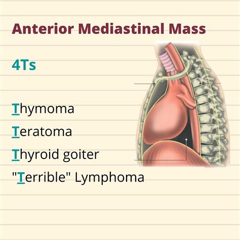 MEDizzy - The classic mnemonic for the differential...