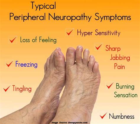 What is Neuropathy (Nerve Damage): Symptoms, Causes & Treatment