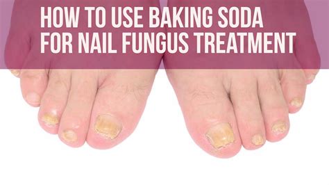 How To Use Baking Soda For Nail Fungus Treatment?