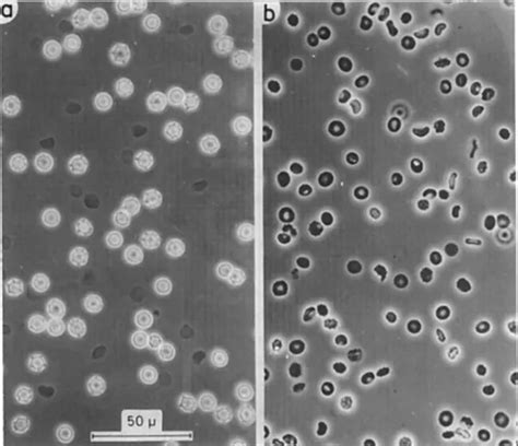 Basics Of Phase Contrast Microscopy | Smacgig World