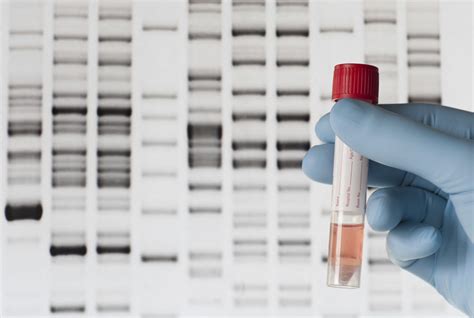 DNA Testing Firms Promise Not to Share Data Without User Consent