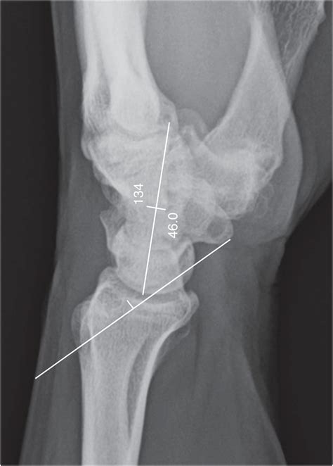 Chapter 3 – Wrist | Musculoskeletal Key