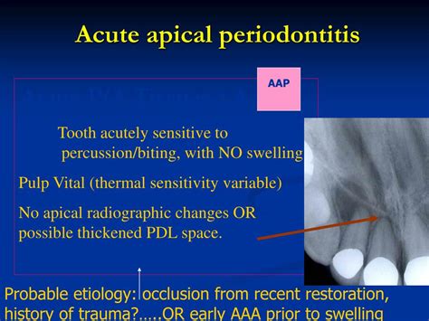 Apical Periodontitis Vs Apical Abscess