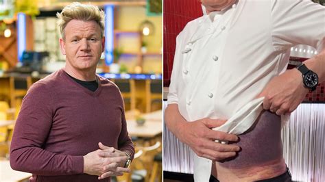 Gordon Ramsay 'lucky' to be alive following serious bicycle accident ...