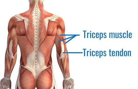 Triceps tendonitis causes and treatment