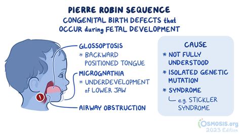 Rare Birth Defect Syndromes