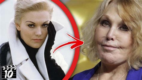 Top 10 Worst Botched Plastic Surgery In Hollywood | Top 10 Worst ...