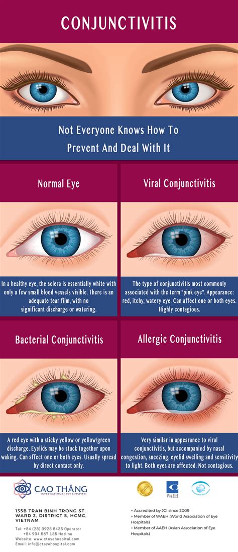 viral vs bacterial pink eye