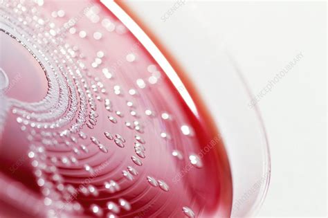 Staphylococcus aureus culture - Stock Image - C036/0545 - Science Photo ...