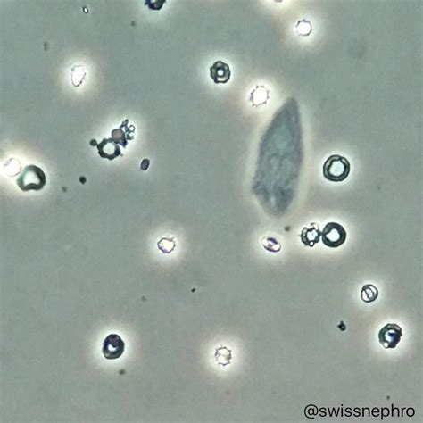 an animal's tail is seen in the water with bubbles and droplets around it