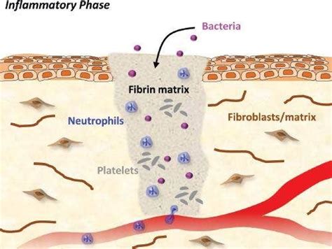 Inflammatory phase of wound healing begins immediately after tissue ...