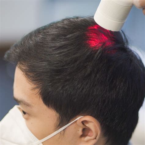 Laser Therapy for Hair Growth | Svenson